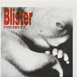 Download Blister - Stitches