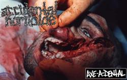 Download Accidental Homicide - Axe A Dental