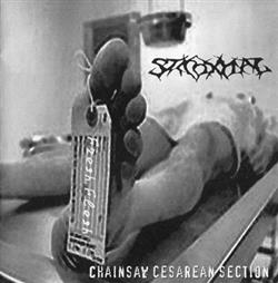 Download Stickoxydal - Chainsaw Cesarean Section